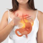 Heartburn Penyebab, Gejala Dan Cara Mengatasinya