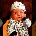 Harlequin Ichthyosis, Penyakit Genetik Yang Sangat Langka!